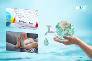 Nước Ion Kiềm: Hỗ Trợ Giảm Axit Uric Và Cải Thiện Bệnh Gout